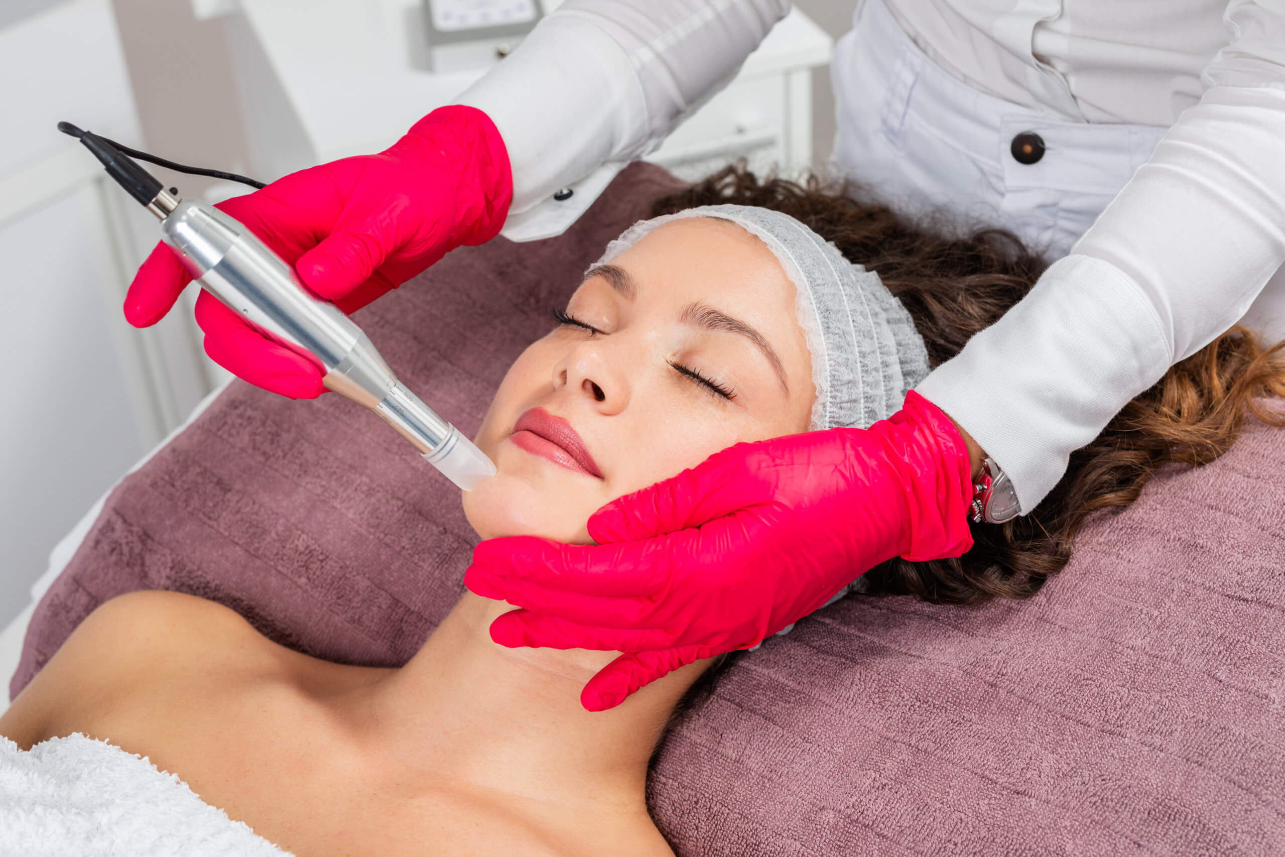 Microneedling with SkinPen | Florida, United States | The Aesthetic House
